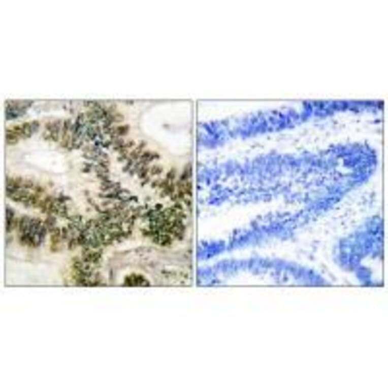 Immunohistochemistry - Cyclin E1 (Ab-395) Antibody from Signalway Antibody (33122) - Antibodies.com