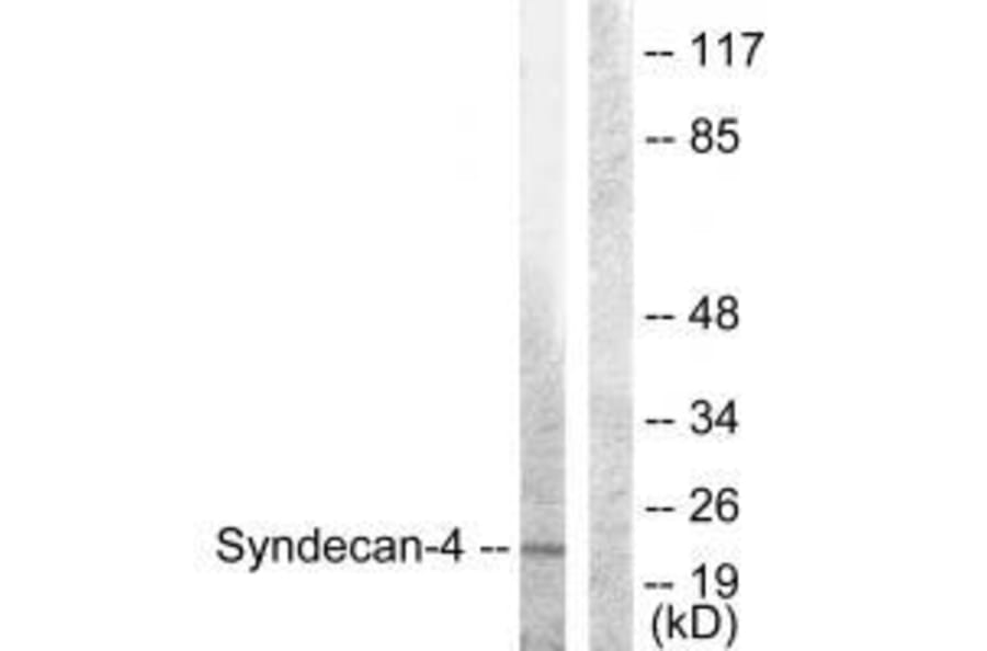 Western blot - Syndecan4 (Ab-179) Antibody from Signalway Antibody (33166) - Antibodies.com