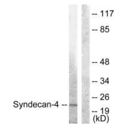 Western blot - Syndecan4 (Ab-179) Antibody from Signalway Antibody (33166) - Antibodies.com