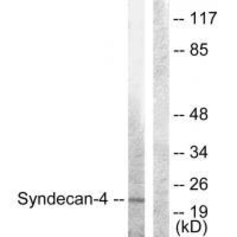 Western blot - Syndecan4 (Ab-179) Antibody from Signalway Antibody (33166) - Antibodies.com