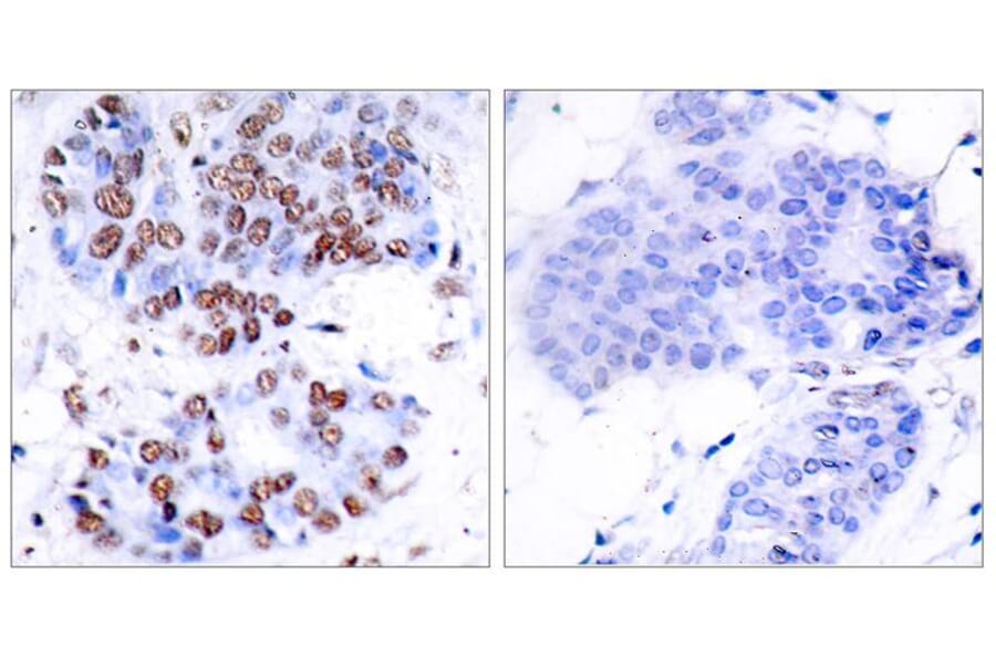 Immunohistochemistry - NFkB-p65 (Ab-276) Antibody from Signalway Antibody (21011) - Antibodies.com