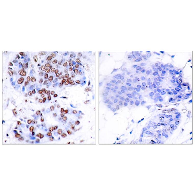 Immunohistochemistry - NFkB-p65 (Ab-276) Antibody from Signalway Antibody (21011) - Antibodies.com