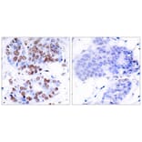 Immunohistochemistry - NFkB-p65 (Ab-276) Antibody from Signalway Antibody (21011) - Antibodies.com