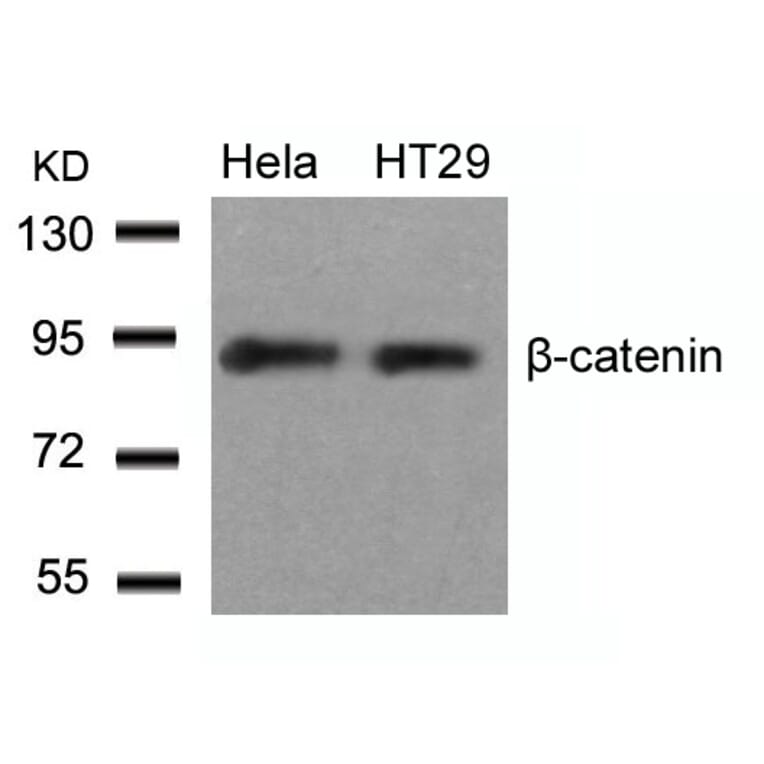 Western blot - b-Catenin (Ab-33) Antibody from Signalway Antibody (21211) - Antibodies.com