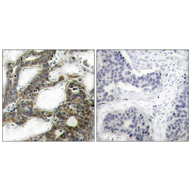 Immunohistochemistry - b-Catenin (Ab-33) Antibody from Signalway Antibody (21211) - Antibodies.com