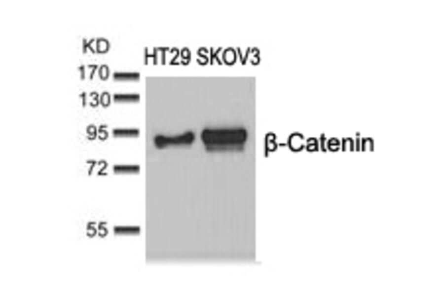 Western blot - b-Catenin (Ab-37) Antibody from Signalway Antibody (21212) - Antibodies.com