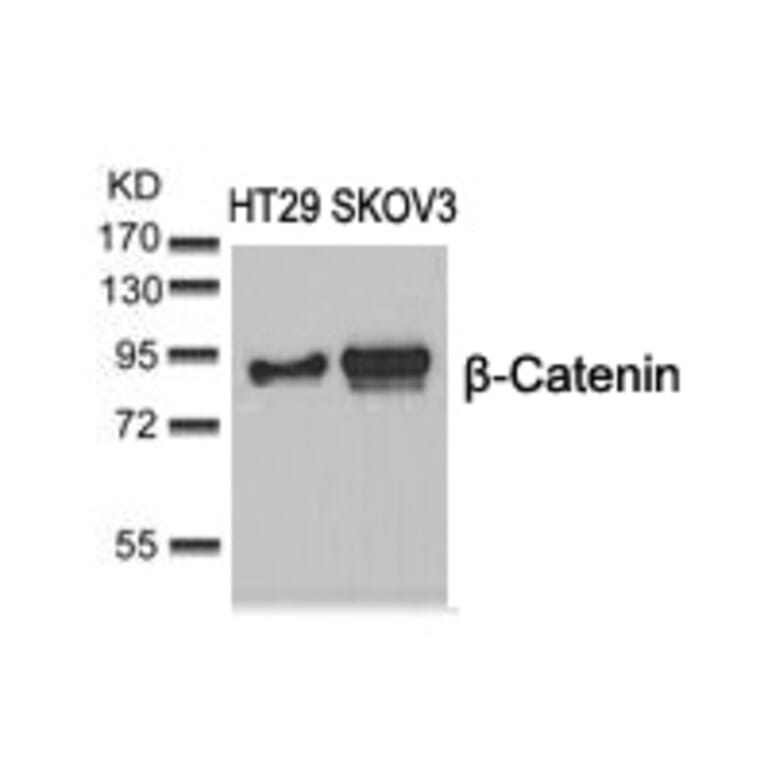 Western blot - b-Catenin (Ab-37) Antibody from Signalway Antibody (21212) - Antibodies.com