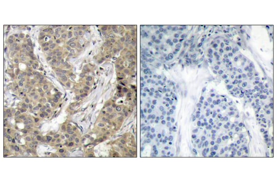 Immunohistochemistry - b-Catenin (Ab-37) Antibody from Signalway Antibody (21212) - Antibodies.com