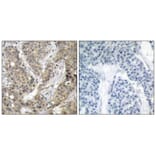 Immunohistochemistry - b-Catenin (Ab-37) Antibody from Signalway Antibody (21212) - Antibodies.com