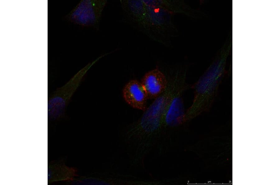 Immunofluorescence - b-Catenin (Ab-37) Antibody from Signalway Antibody (21212) - Antibodies.com