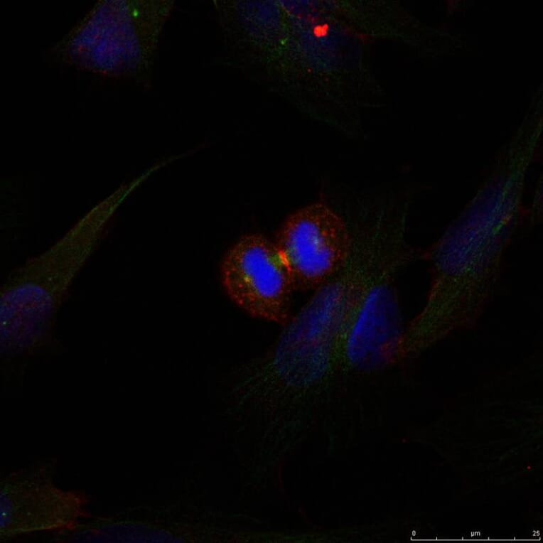 Immunofluorescence - b-Catenin (Ab-37) Antibody from Signalway Antibody (21212) - Antibodies.com
