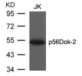 Western blot - p56Dok-2 (Ab-299) Antibody from Signalway Antibody (21270) - Antibodies.com