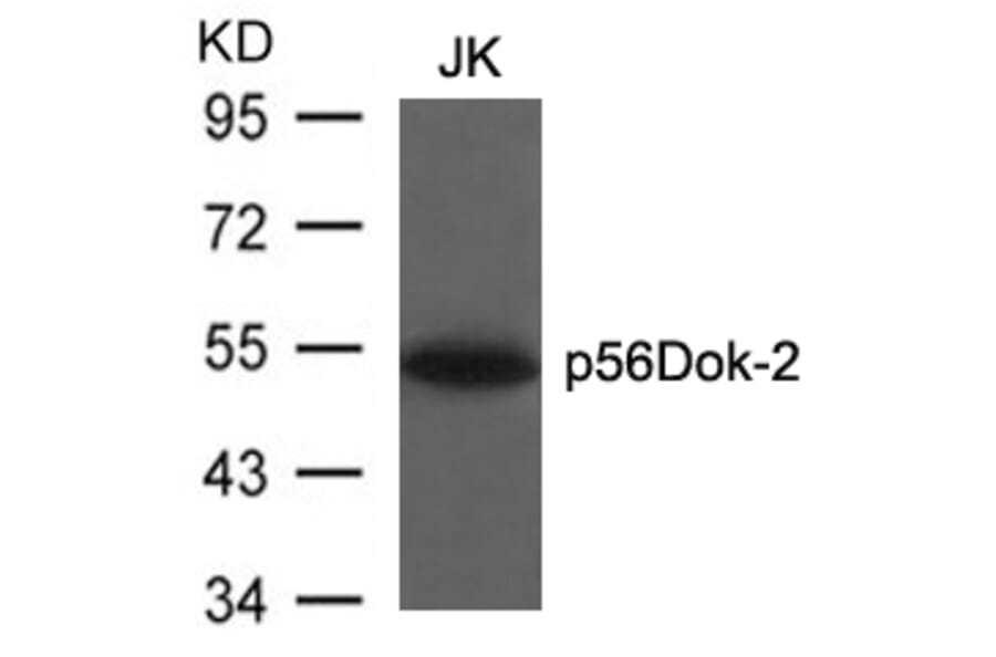 Western blot - p56Dok-2 (Ab-299) Antibody from Signalway Antibody (21270) - Antibodies.com