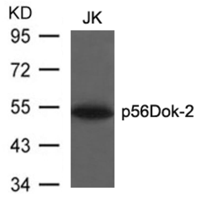 Western blot - p56Dok-2 (Ab-299) Antibody from Signalway Antibody (21270) - Antibodies.com