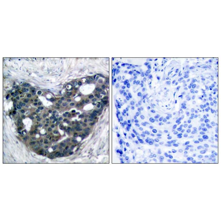 Immunohistochemistry - p56Dok-2 (Ab-299) Antibody from Signalway Antibody (21270) - Antibodies.com