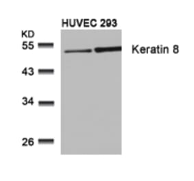 Western blot - Keratin 8 (Ab-74) Antibody from Signalway Antibody (21307) - Antibodies.com