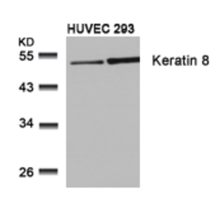 Western blot - Keratin 8 (Ab-74) Antibody from Signalway Antibody (21307) - Antibodies.com