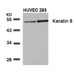 Western blot - Keratin 8 (Ab-74) Antibody from Signalway Antibody (21307) - Antibodies.com