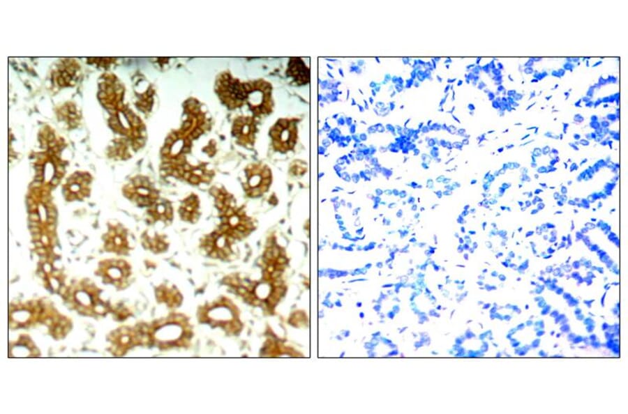 Immunohistochemistry - Keratin 8 (Ab-74) Antibody from Signalway Antibody (21307) - Antibodies.com