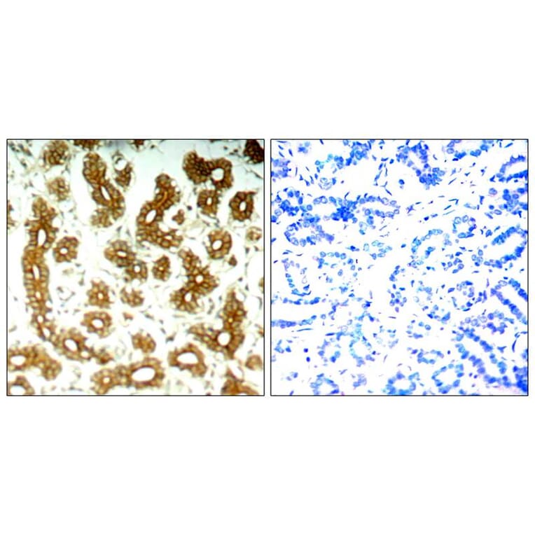 Immunohistochemistry - Keratin 8 (Ab-74) Antibody from Signalway Antibody (21307) - Antibodies.com