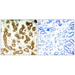 Immunohistochemistry - Keratin 8 (Ab-74) Antibody from Signalway Antibody (21307) - Antibodies.com