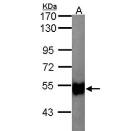 glycerol kinase 2 antibody from Signalway Antibody (22677) - Antibodies.com