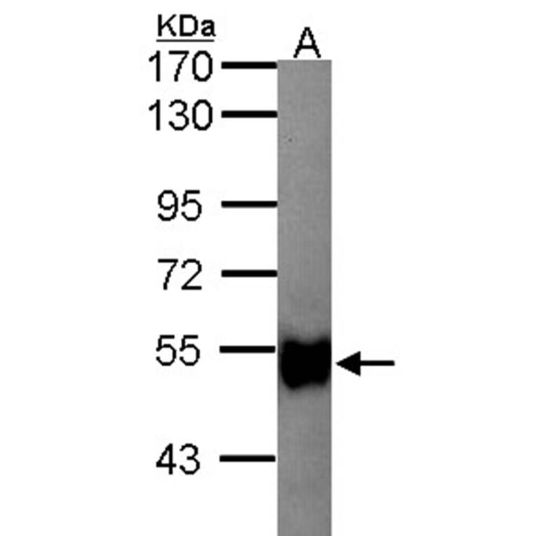 glycerol kinase 2 antibody from Signalway Antibody (22677) - Antibodies.com