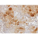 Immunohistochemistry - glycerol kinase 2 antibody from Signalway Antibody (22677) - Antibodies.com