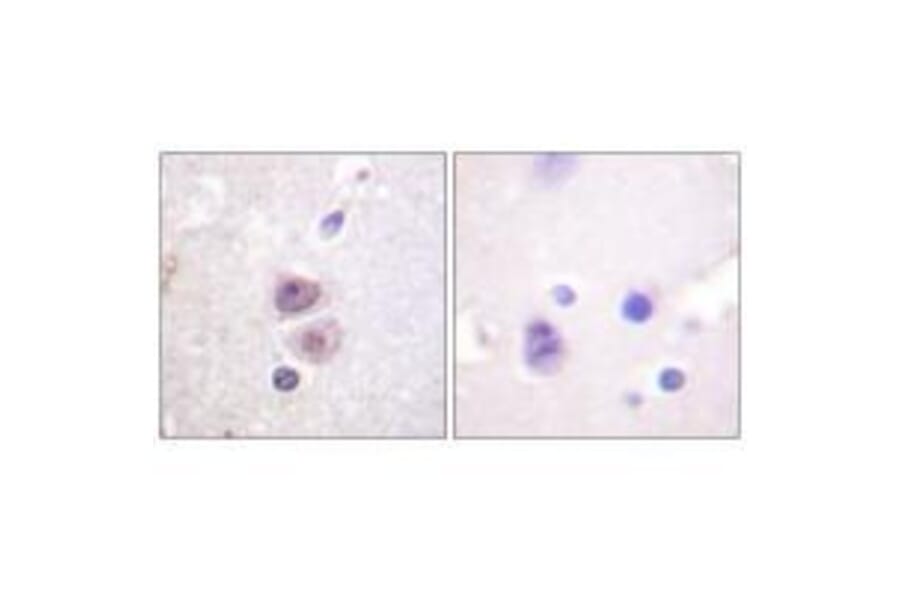 Immunohistochemistry - p38 MAPK (Ab-322) Antibody from Signalway Antibody (33149) - Antibodies.com