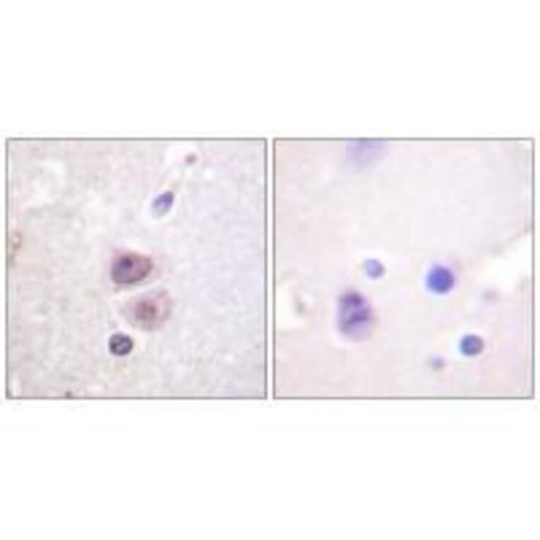 Immunohistochemistry - p38 MAPK (Ab-322) Antibody from Signalway Antibody (33149) - Antibodies.com