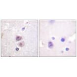 Immunohistochemistry - p38 MAPK (Ab-322) Antibody from Signalway Antibody (33149) - Antibodies.com