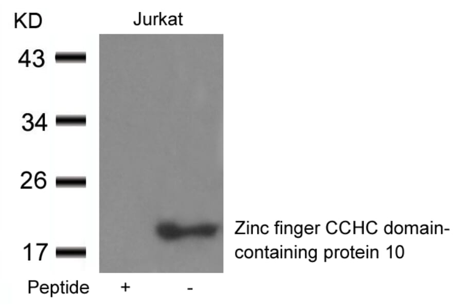 Western blot - Zinc finger CCHC domain-containing protein 10 Antibody from Signalway Antibody - Antibodies.com