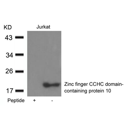 Western blot - Zinc finger CCHC domain-containing protein 10 Antibody from Signalway Antibody - Antibodies.com