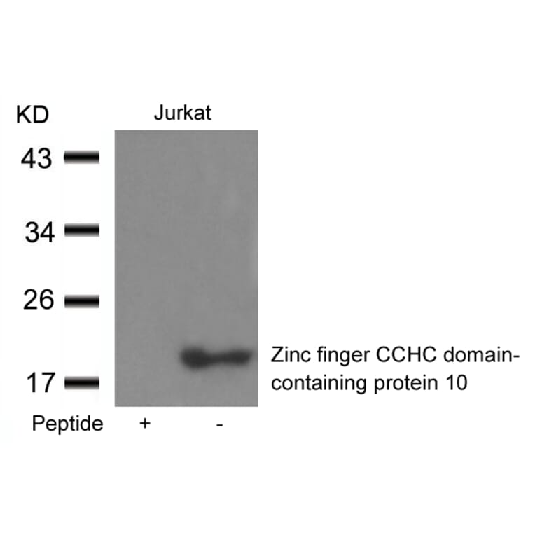 Western blot - Zinc finger CCHC domain-containing protein 10 Antibody from Signalway Antibody - Antibodies.com