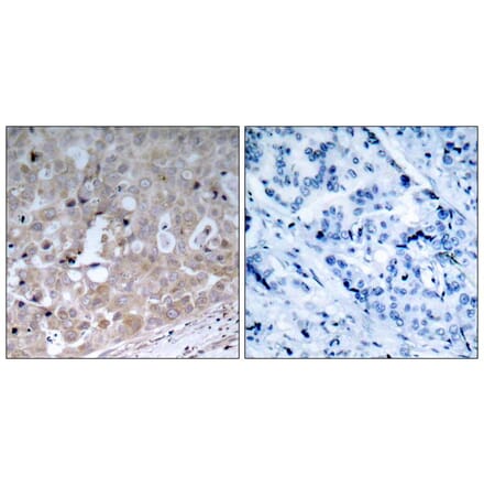 Immunohistochemistry - VEGFR2 (Ab-1175) Antibody from Signalway Antibody (21077) - Antibodies.com