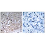 Immunohistochemistry - VEGFR2 (Ab-1175) Antibody from Signalway Antibody (21077) - Antibodies.com