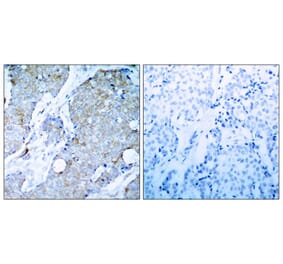 Immunohistochemistry - VEGFR2 (Ab-1214) Antibody from Signalway Antibody (21078) - Antibodies.com