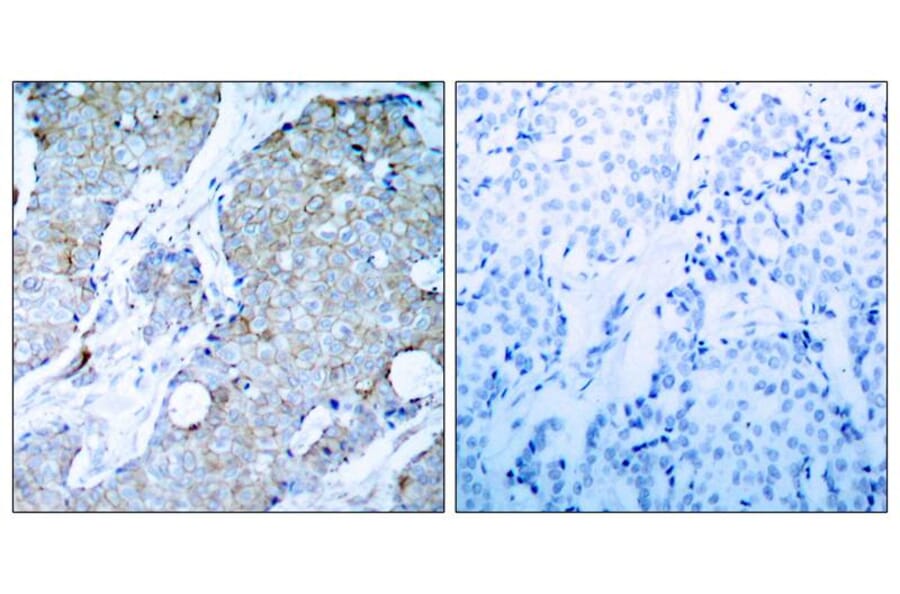 Immunohistochemistry - VEGFR2 (Ab-1214) Antibody from Signalway Antibody (21078) - Antibodies.com
