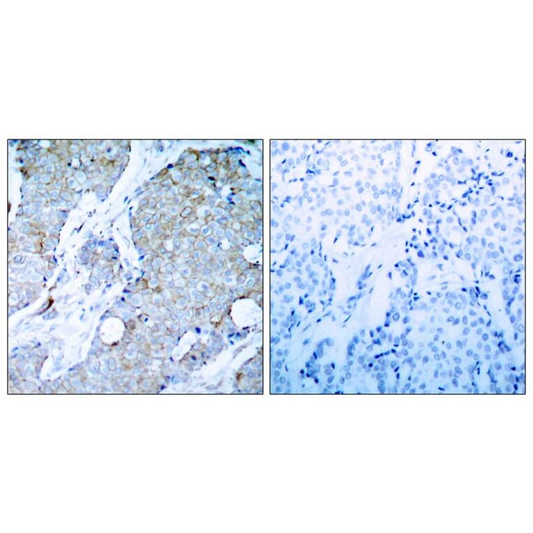 Immunohistochemistry - VEGFR2 (Ab-1214) Antibody from Signalway Antibody (21078) - Antibodies.com