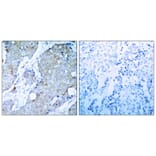 Immunohistochemistry - VEGFR2 (Ab-1214) Antibody from Signalway Antibody (21078) - Antibodies.com