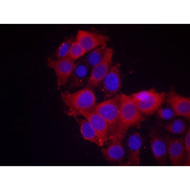 Immunofluorescence - VEGFR2 (Ab-1214) Antibody from Signalway Antibody (21078) - Antibodies.com