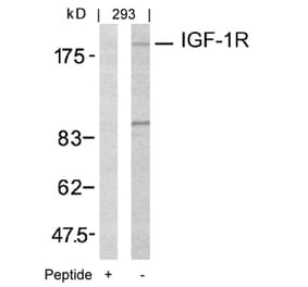 Western blot - IGF-1R (Ab-1161) Antibody from Signalway Antibody (21080) - Antibodies.com