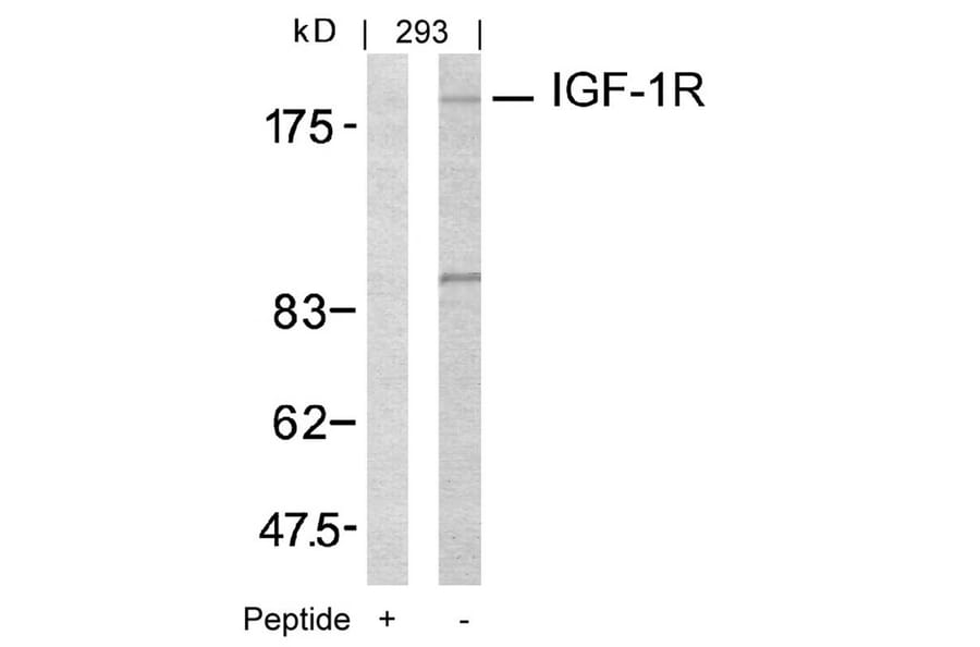 Western blot - IGF-1R (Ab-1161) Antibody from Signalway Antibody (21080) - Antibodies.com