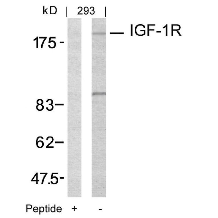 Western blot - IGF-1R (Ab-1161) Antibody from Signalway Antibody (21080) - Antibodies.com