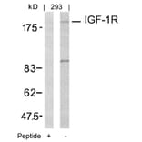 Western blot - IGF-1R (Ab-1161) Antibody from Signalway Antibody (21080) - Antibodies.com