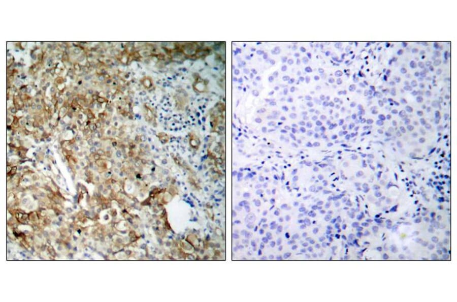 Immunohistochemistry - IGF-1R (Ab-1161) Antibody from Signalway Antibody (21080) - Antibodies.com