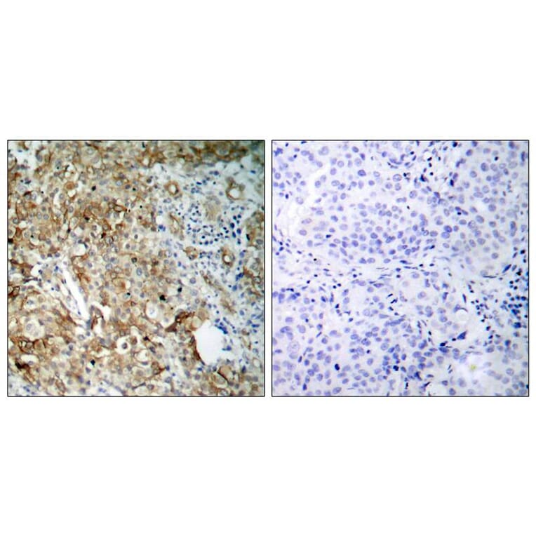 Immunohistochemistry - IGF-1R (Ab-1161) Antibody from Signalway Antibody (21080) - Antibodies.com