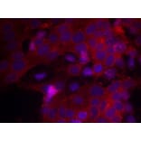Immunofluorescence - IGF-1R (Ab-1161) Antibody from Signalway Antibody (21080) - Antibodies.com