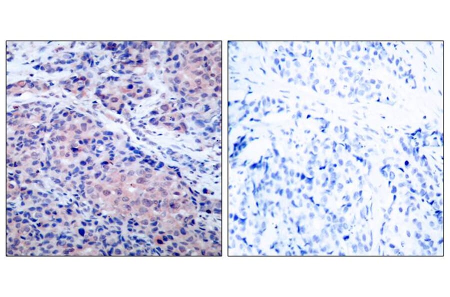 Immunohistochemistry - IkB-a (Ab-32/36) Antibody from Signalway Antibody (21122) - Antibodies.com