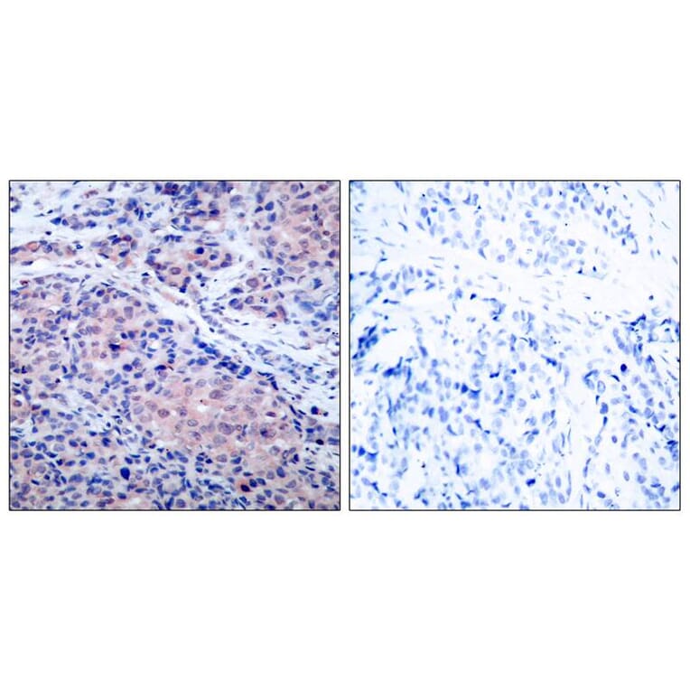 Immunohistochemistry - IkB-a (Ab-32/36) Antibody from Signalway Antibody (21122) - Antibodies.com